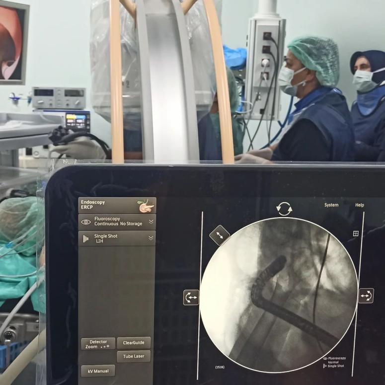 Hastaneye ERCP ünitesi açıldı